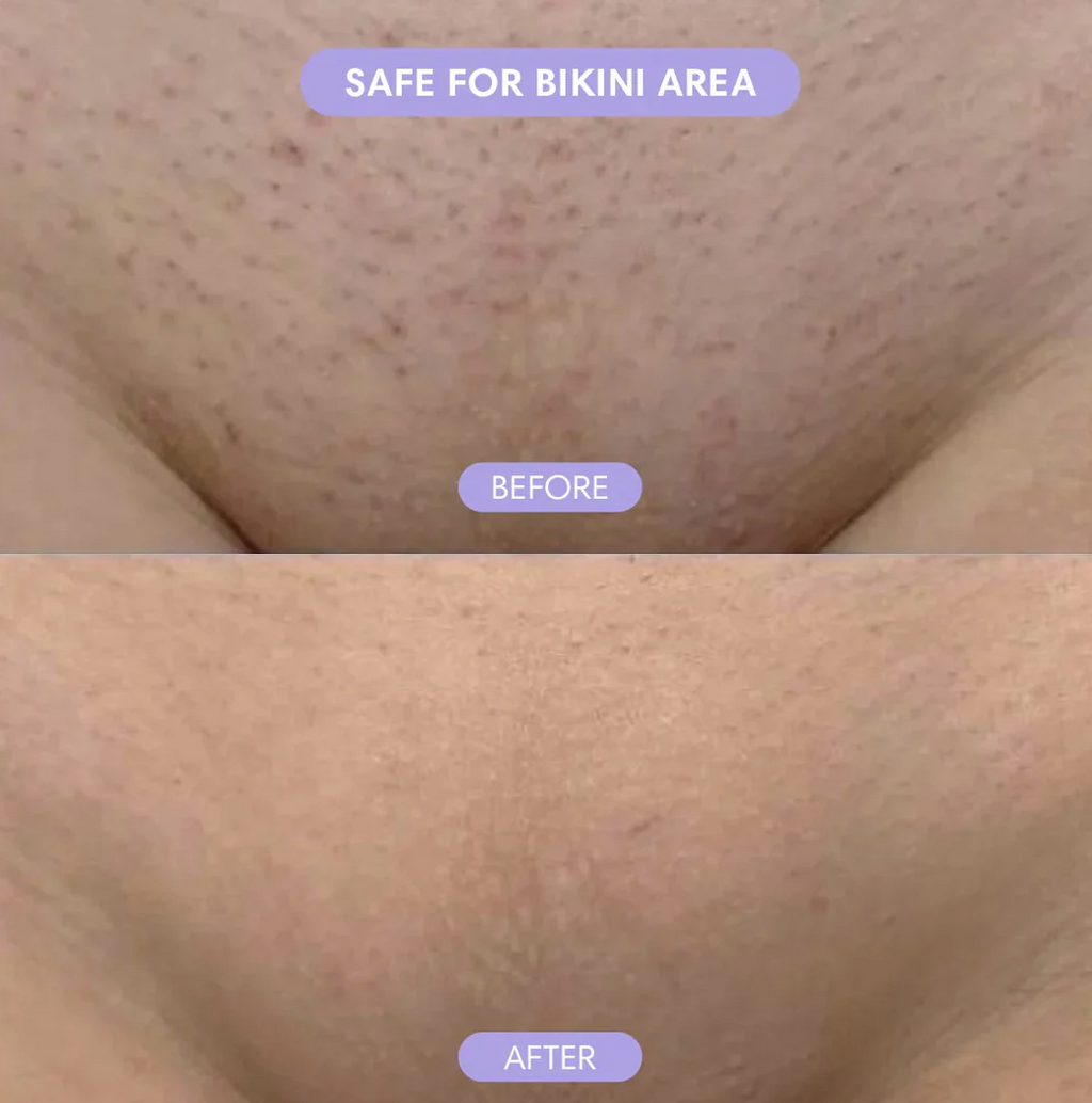 Cloud Sense™ Hair Removal Spray