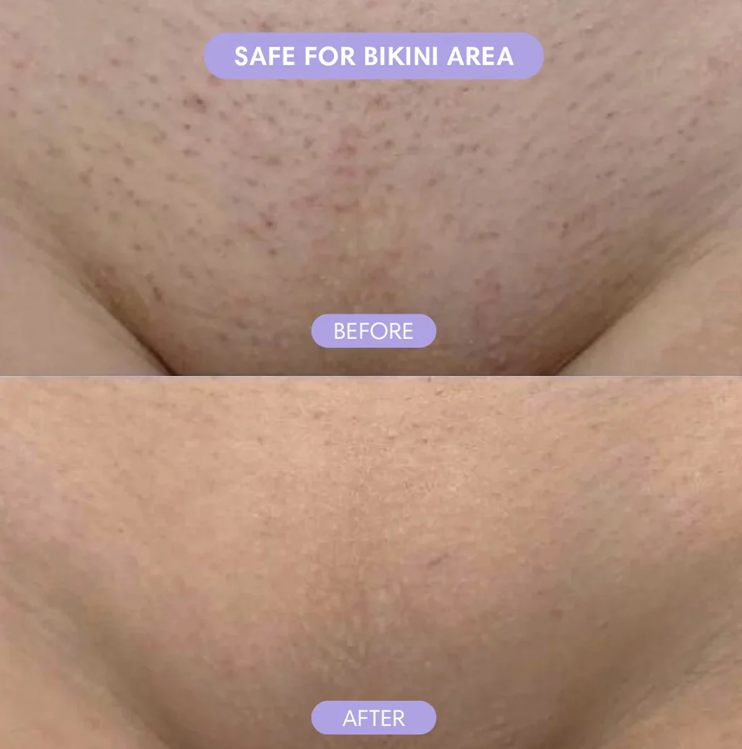 Cloud Sense™ Hair Removal Spray