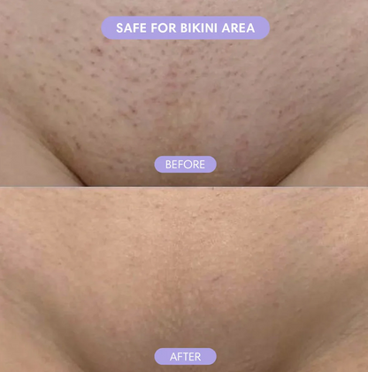 Cloud Sense™ Hair Removal Spray