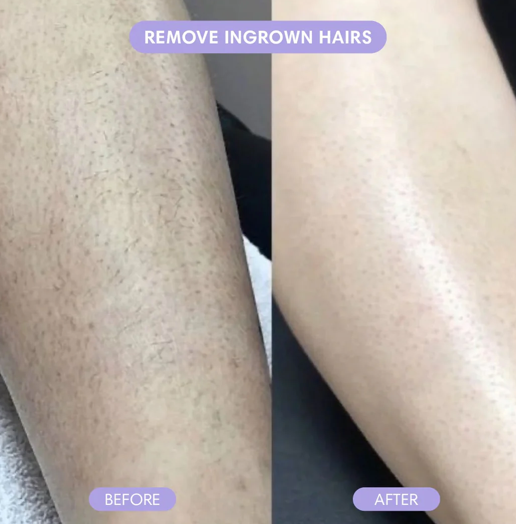 Cloud Sense™ Hair Removal Spray